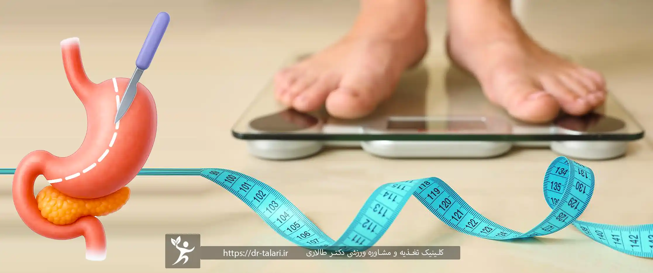 جراحی اسلیو معده